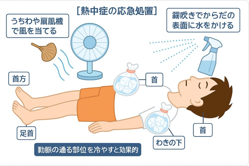 熱中症の応急処置